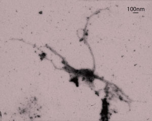 TEM image of DISC1 aggregate