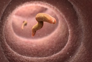 Image of parasitic worms