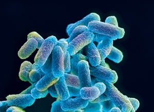 Microscopic image of E. coli
