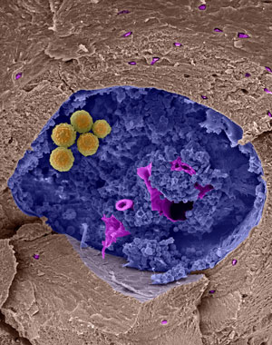 Image of bone marrow cavity