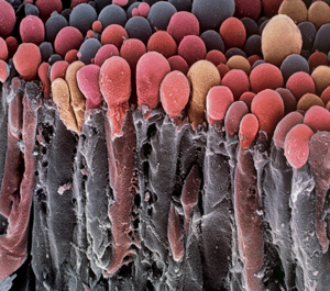 Image of choroid plexus cells