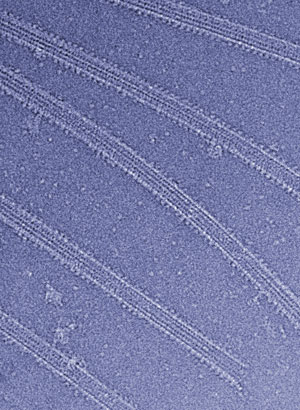 Image of microtubules