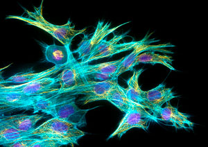 Image of fibroblasts