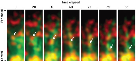 Image of a TCR-MC traveling along microtubules