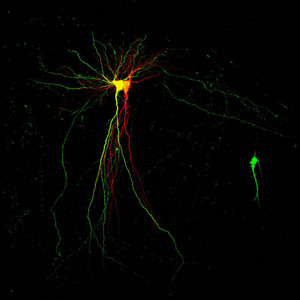 Image of pyramidal neuron a synapse