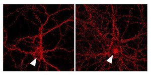 Image of cultured hippocampal neurons