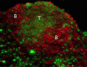 Image of artificial lymph node Image of artificial lymph node
