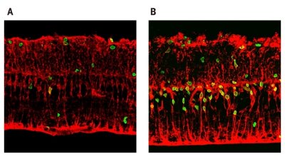 Image of regeneration of retinas