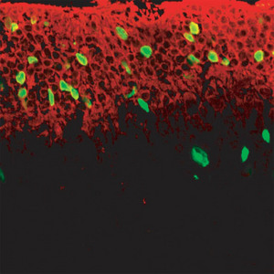 Image of photoreceptor cells 