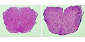 Images of normal and inflamed spinal cords