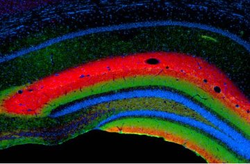 Image showing a section of the hippocampus