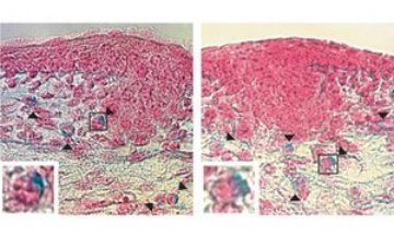 images of mast cells in normal and mutant mouse embryos