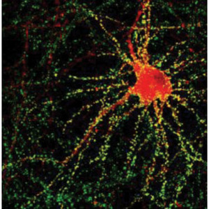 Image of neurons
