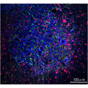 Image of neuronal, microglial and astrocytic cells