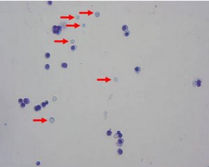 Image of the erythroid cell line