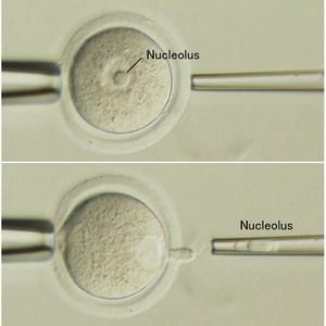 Image of removing nucleolus from an oocyte