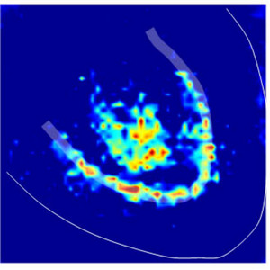 Optical imaging of brain waves using a voltage sensitive dye