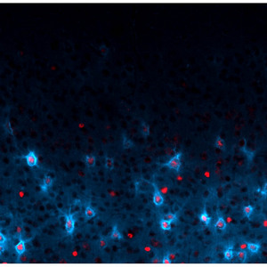 Image of Otx2 in PV-cells