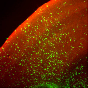 Image of neuronal precursors