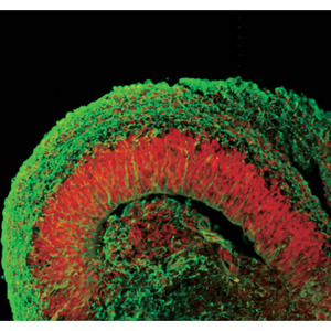 Image of human ESCs