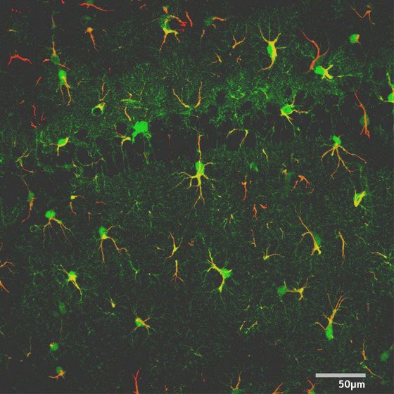 Image of astrocytes