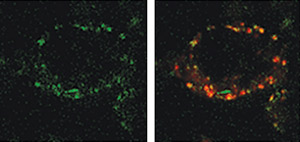 Image showing the localization of misfolded Huntingtin protein