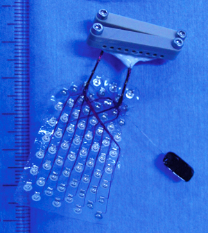 Image of an electrode array Image of an electrode array