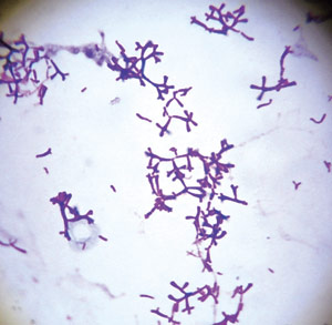 Image of bacteria