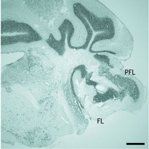 Image of the flocculus and paraflocculus in the brain