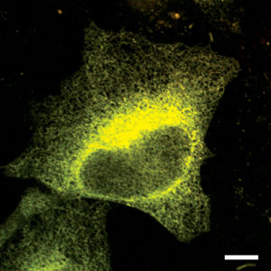 Image of a cell emitting fluorescent