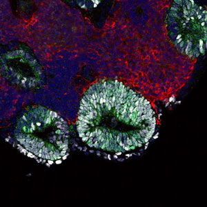 Image of an embryonic pituitary gland Image of an embryonic pituitary gland