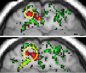 Image obtained by fMRI