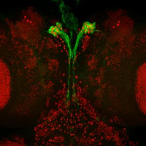 Image of a fruit fly brain