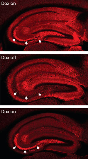 Images of CA region of the brain