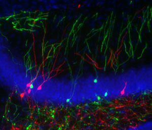 Image of granule cells