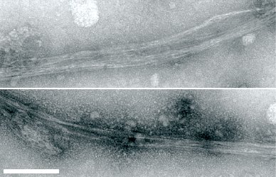 Image of amyloid aggregates