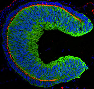 Image of an embryonic eye