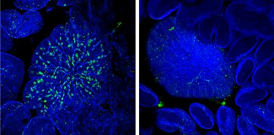 Image of M cells