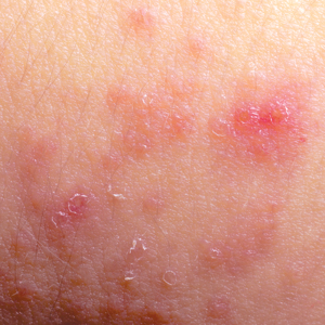 Image of skin Image of skin