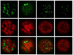 Image of FBX proteins in plant leaves