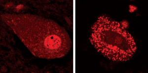 Image of TDP-43