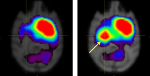 Image of brain scans