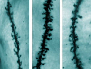 Image of dendritic spines
