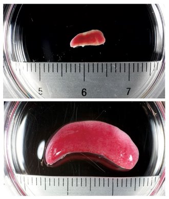 Image of spleens from mice