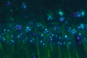 Image of prefoldin protein expression in mice
