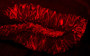 Image of the dentate gyrus
