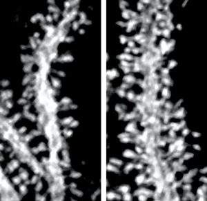 Image of mouse Purkinje cells
