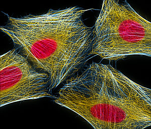 Image of Hela cells