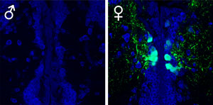 Image of the brains of male and female medaka fish