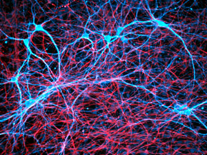 Image of neurons